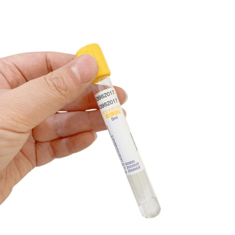 หลอดเก็บเลือดสุญญากาศแบบใช้แล้ - Medical Lab Blood Test บทวิจารณ์และราคา
